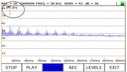 ultrasound5 ultrasound5