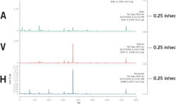 Figure 4. Spectra plotted in A-V-H order on the same amplitude scale. Figure 4. Spectra plotted in A-V-H order on the same amplitude scale.