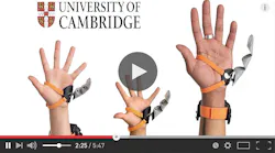 Easy-to-use robotic appendage gets 3 thumbs up (literally)